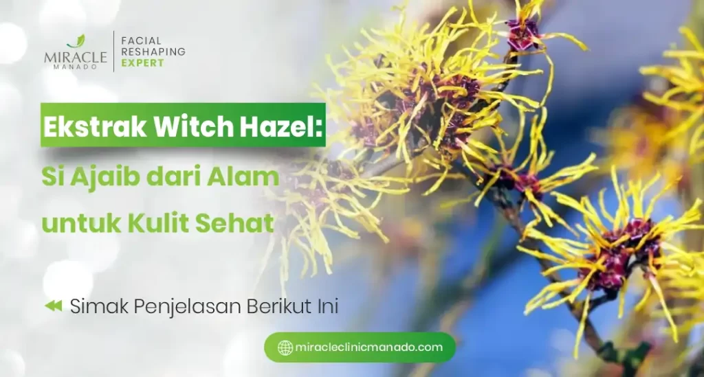 Ekstrak Witch Hazel: Si Ajaib dari Alam untuk Kulit Sehat