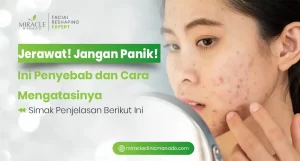 Jerawat? Jangan Panik! Ini Penyebab dan Cara Mengatasinya