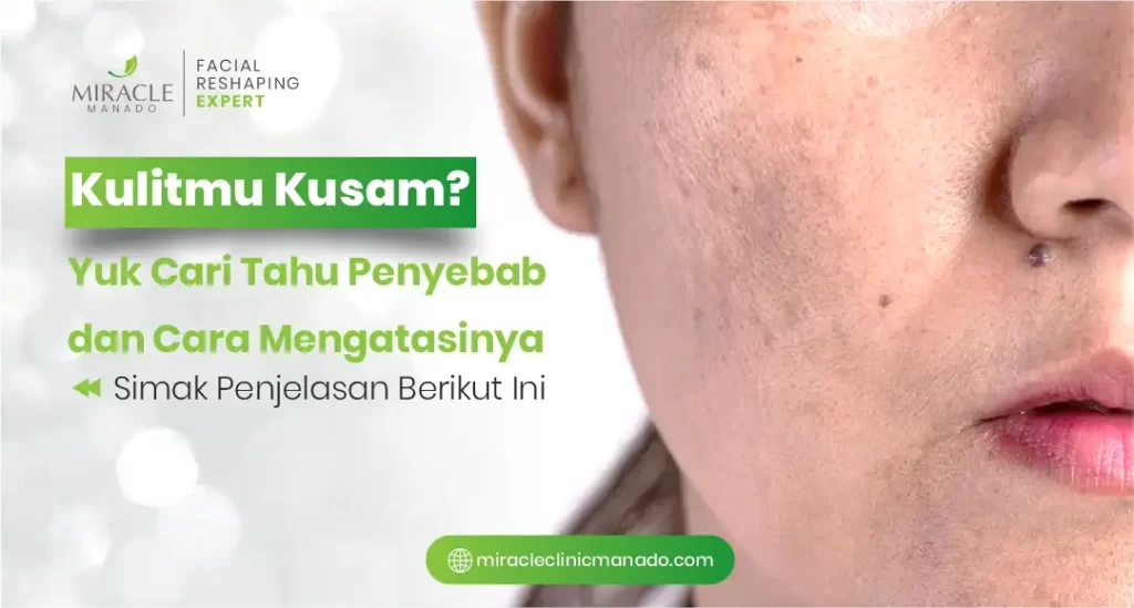 Kulit Kusam? Yuk, Cari Tahu Penyebab dan Cara Mengatasinya!