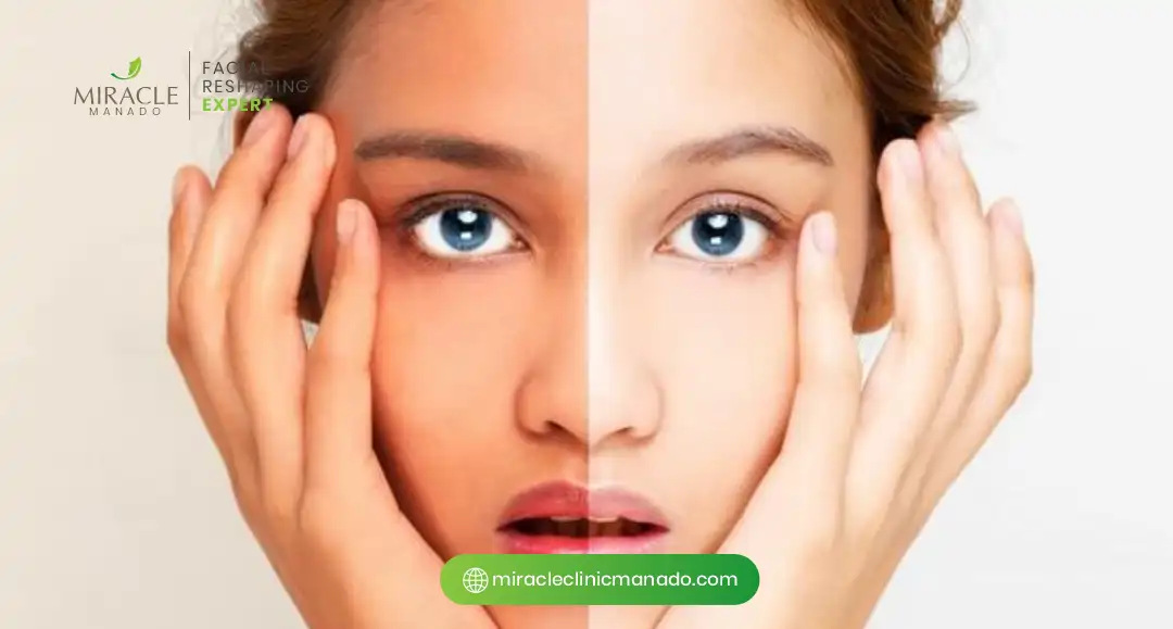 Manfaat Glycolic Acid untuk Warna Kulit yang Lebih Rata