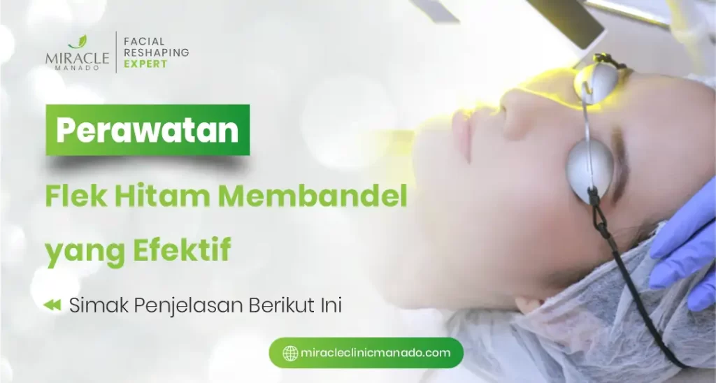 Perawatan Flek Hitam Membandel yang Efektif