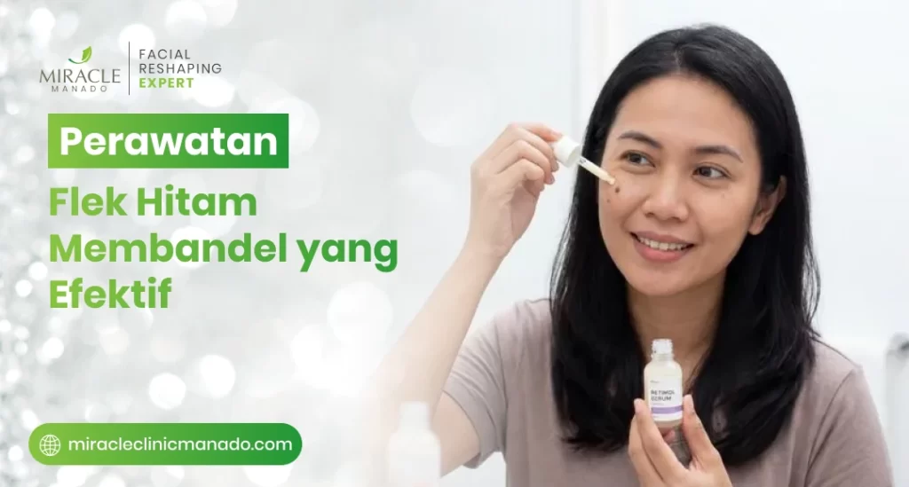 Perawatan Flek Hitam Membandel yang Efektif