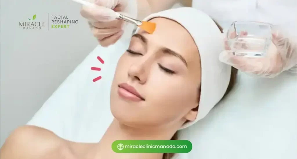 Efek Chemical Peeling untuk Kulit