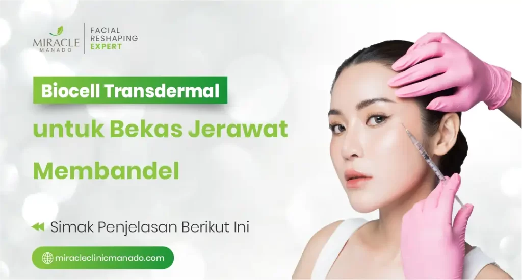 Biocell Transdermal untuk Bekas Jerawat Membandel