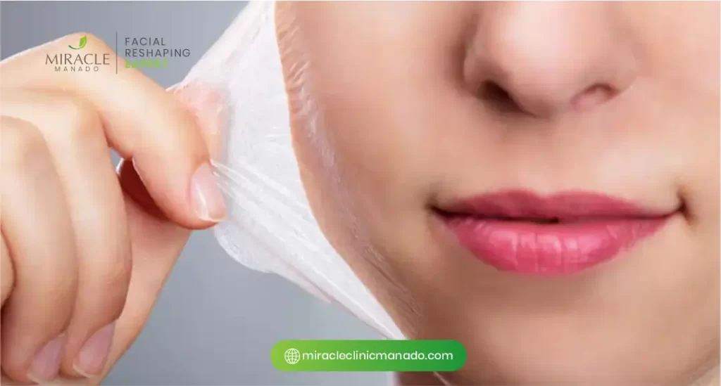 Jenis-Jenis Peeling yang Cocok untuk Kulit Berminyak dan Berjerawat