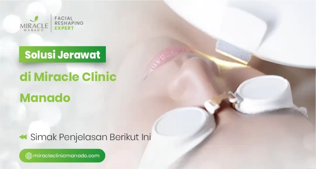 Solusi Jerawat di Miracle Clinic Manado