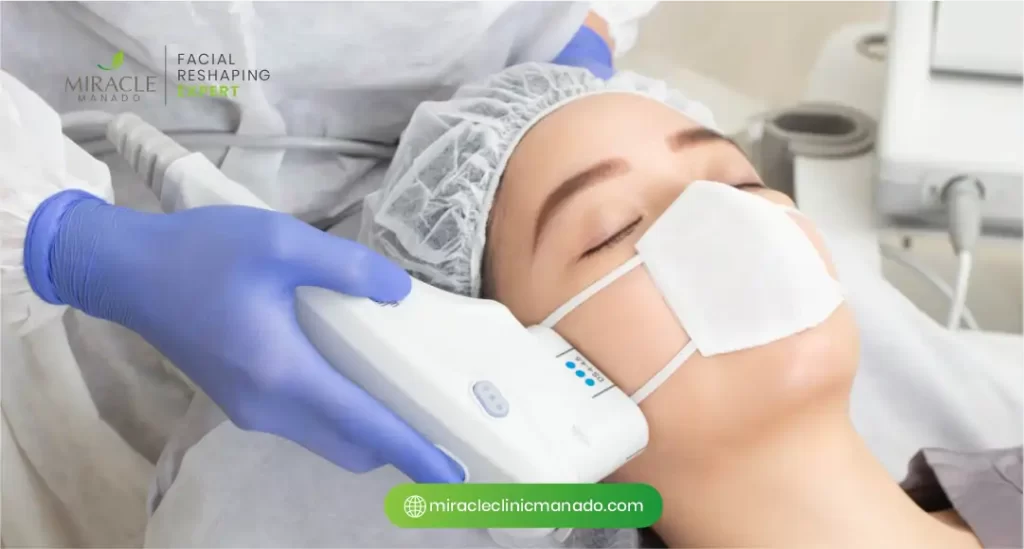 Teknologi dan Perawatan Jerawat di Miracle Clinic Manado