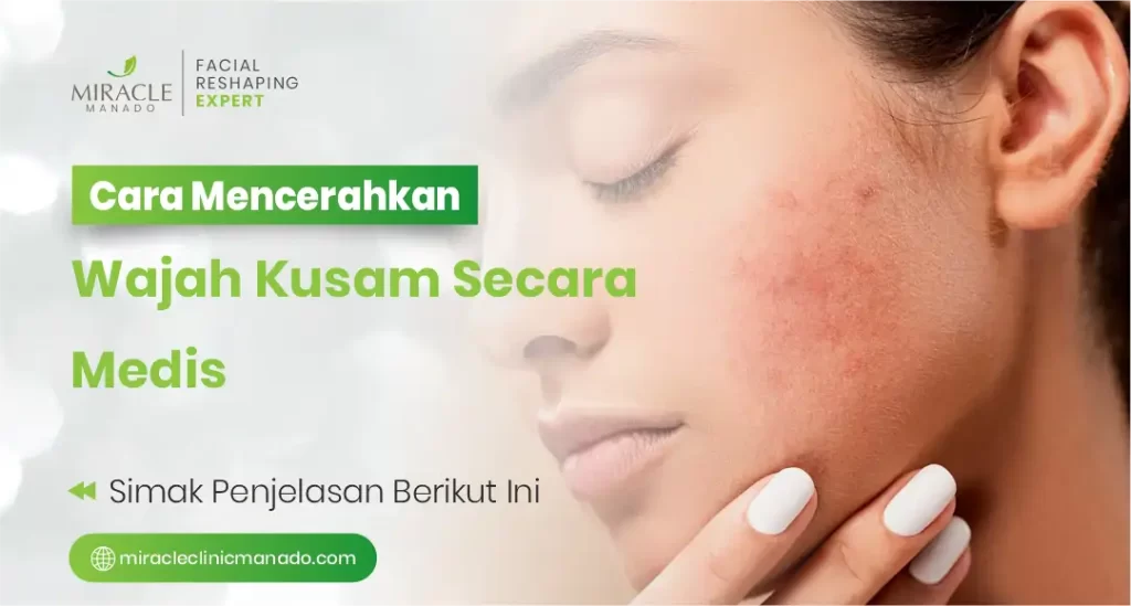 Cara Mencerahkan Wajah Kusam Secara Medis