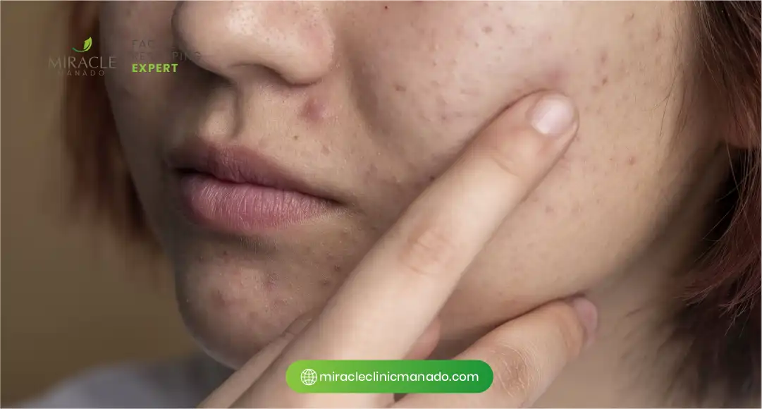 Penyebab Wajah Kusam