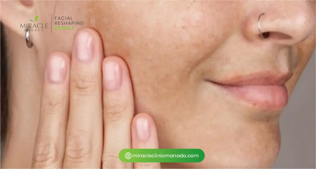 Jenis-Jenis Flek Hitam