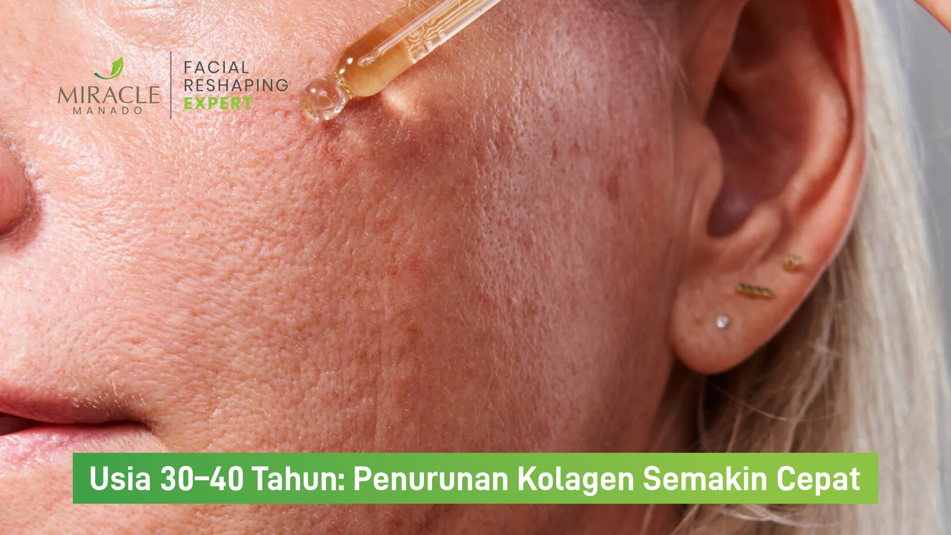 Usia 30–40 Tahun: Penurunan Kolagen Semakin Cepat