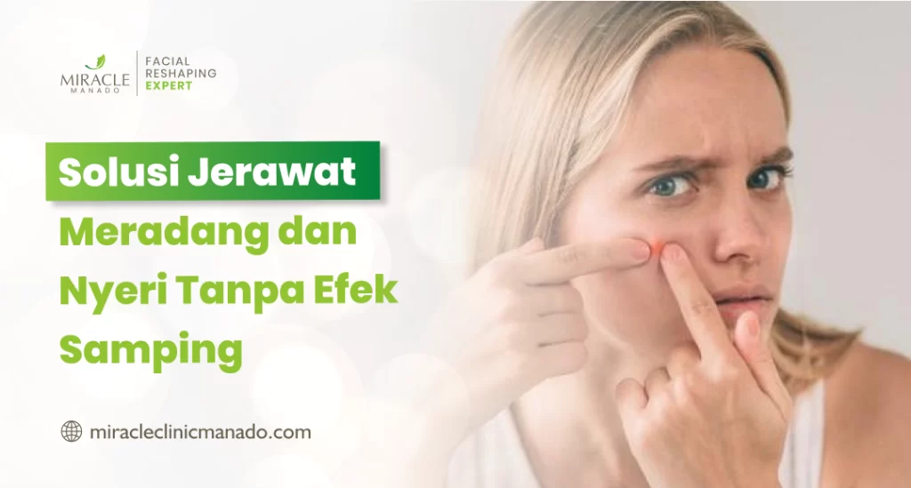 Solusi Jerawat Meradang dan Nyeri Tanpa Efek Samping