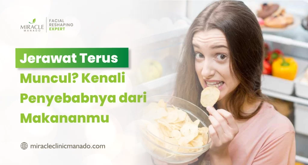 penyebab jerawat terus muncul