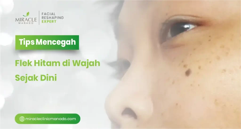 Tips Mencegah Flek Hitam di Wajah Sejak Dini