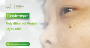 Tips Mencegah Flek Hitam di Wajah Sejak Dini