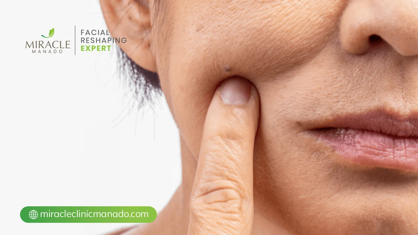 Apa Itu Kulit Dehidrasi?