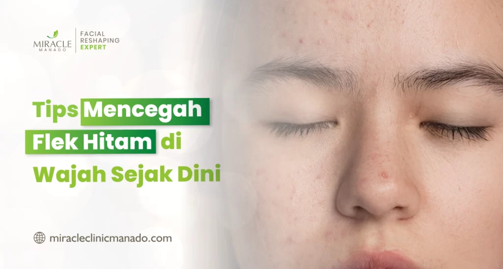 Tips Mencegah Flek Hitam di Wajah Sejak Dini