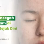 Tips Mencegah Flek Hitam di Wajah Sejak Dini