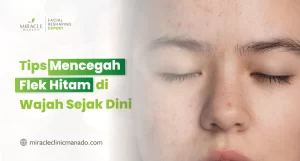 Tips Mencegah Flek Hitam di Wajah Sejak Dini