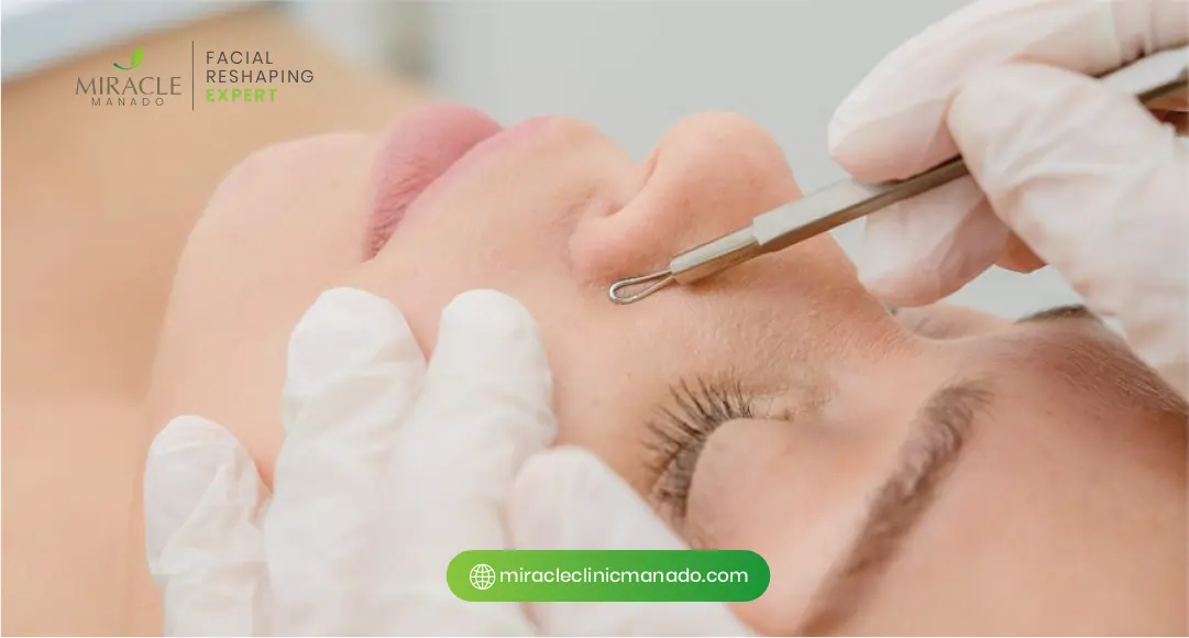 Apakah Facial Bisa Hilangkan Komedo Secara Efektif
