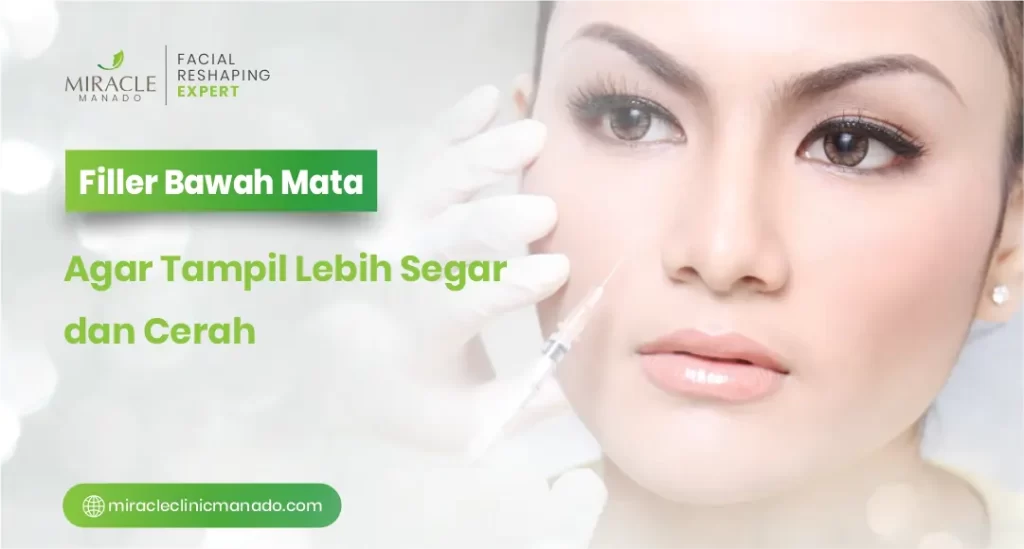 Filler Bawah Mata Agar Tampil Lebih Segar dan Cerah