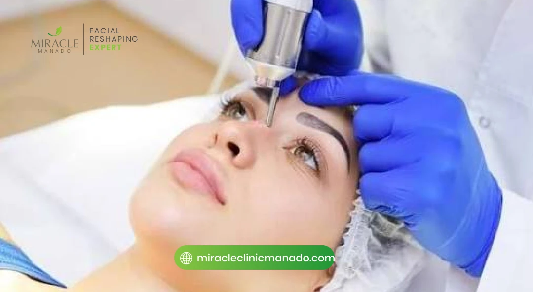 Menghilangkan Bekas Jerawat Pakai Treatment Apa ?