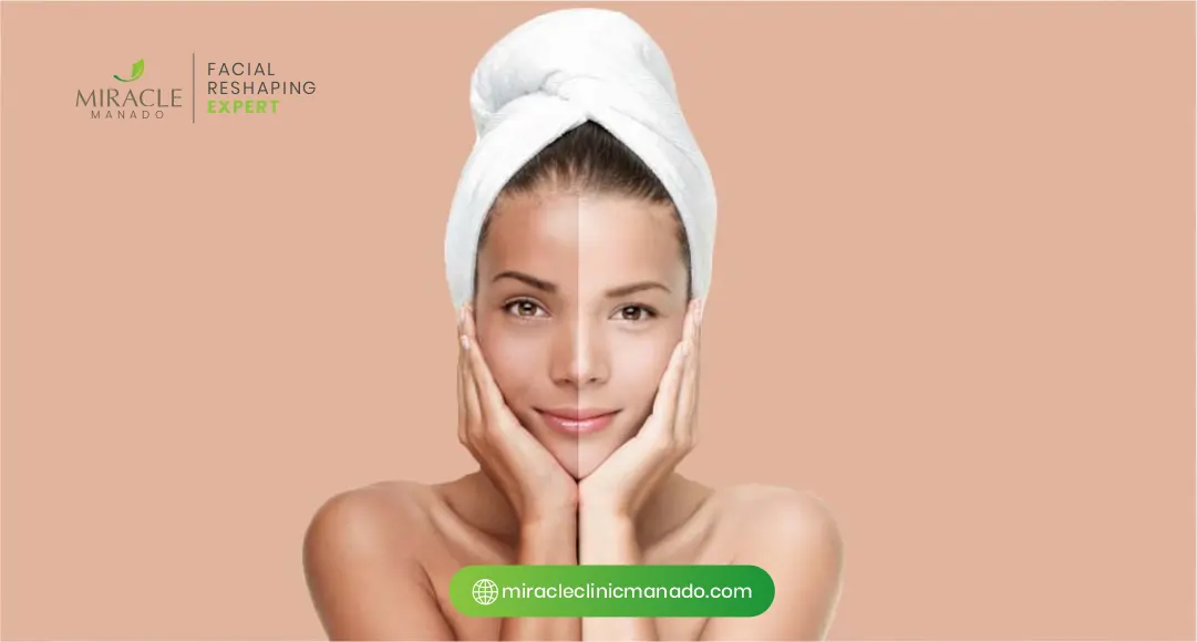 Apa itu Whitening