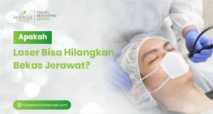 Apakah Laser Bisa Hilangkan Bekas Jerawat?