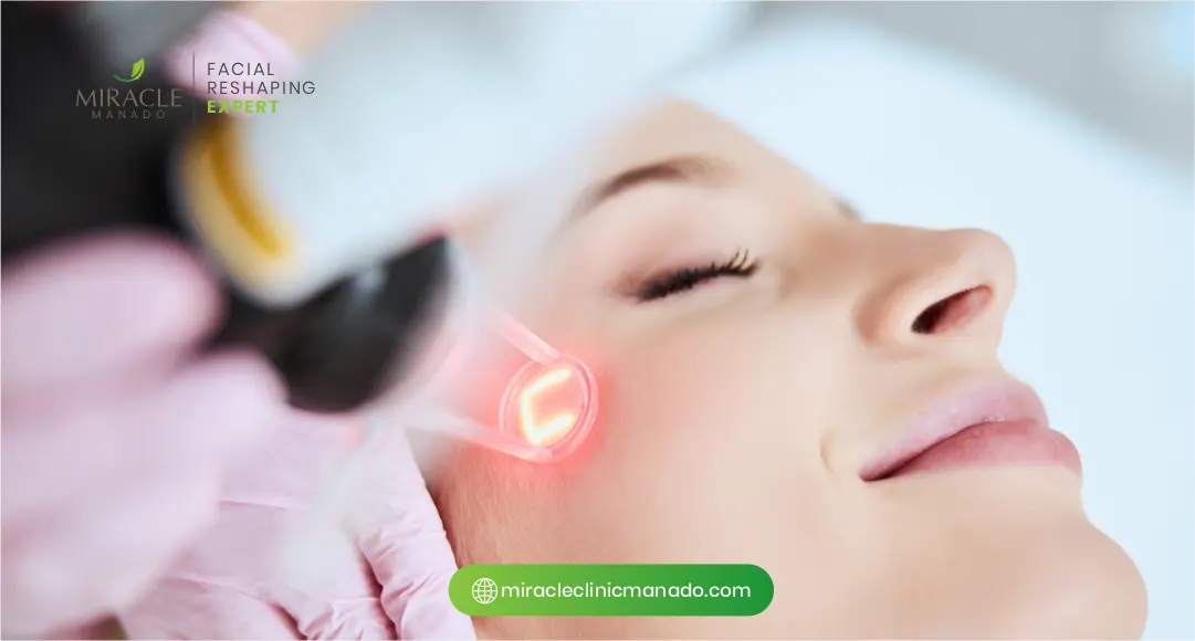 Bagaimana Teknologi Laser Bekerja pada Bekas Jerawat