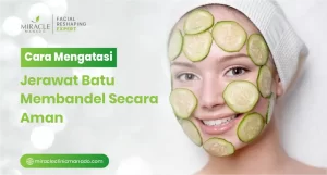 Cara Mengatasi Jerawat Batu Membandel Secara Aman