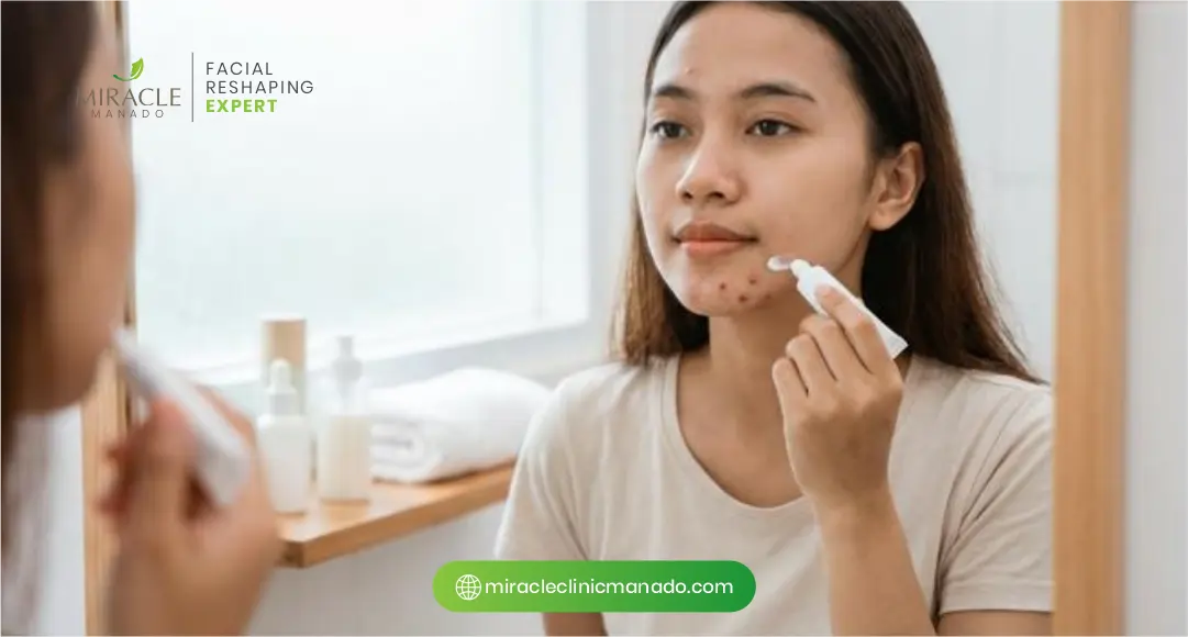Perawatan Lanjutan agar Jerawat Batu Tidak Kambuh