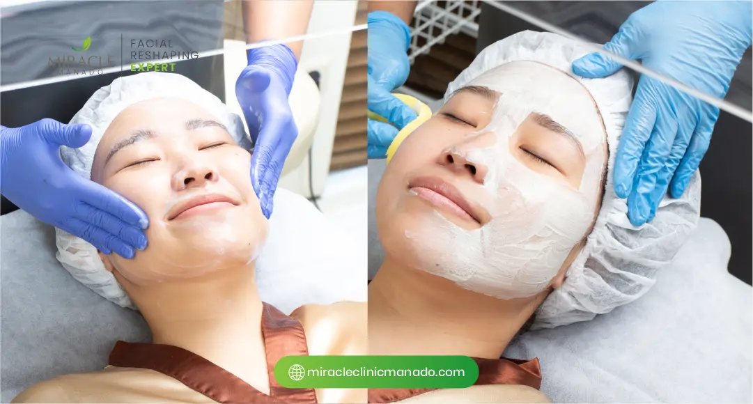 Persiapan Wajah Sebelum dan Sesudah Chemical Peeling
