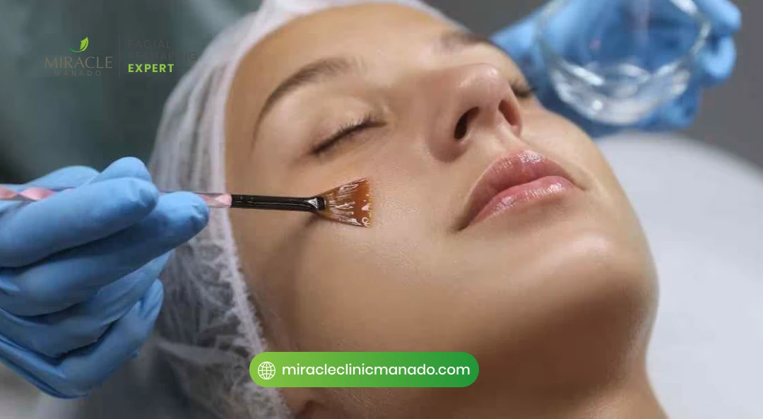 Apa Itu Peeling Kimia?