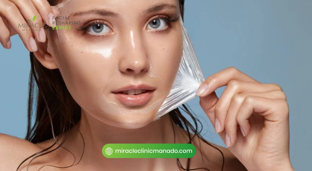 Cara Kerja Peeling Kimia untuk Kulit Berjerawat