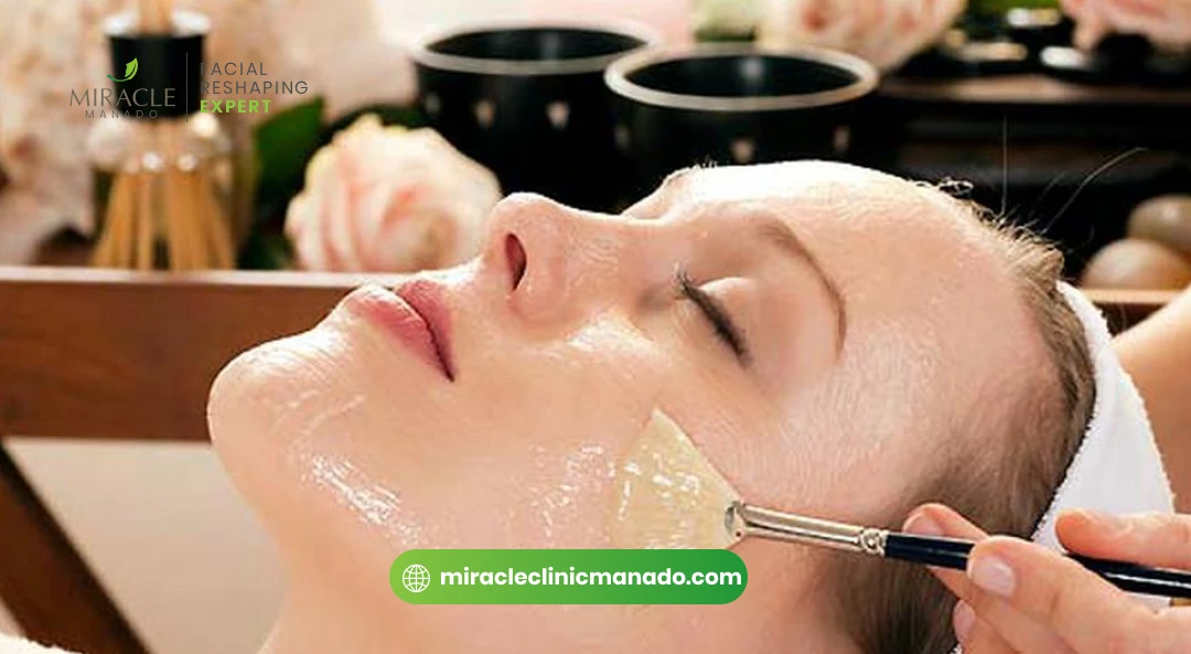 Jenis Peeling Kimia untuk Kulit Berjerawat yang Efektif