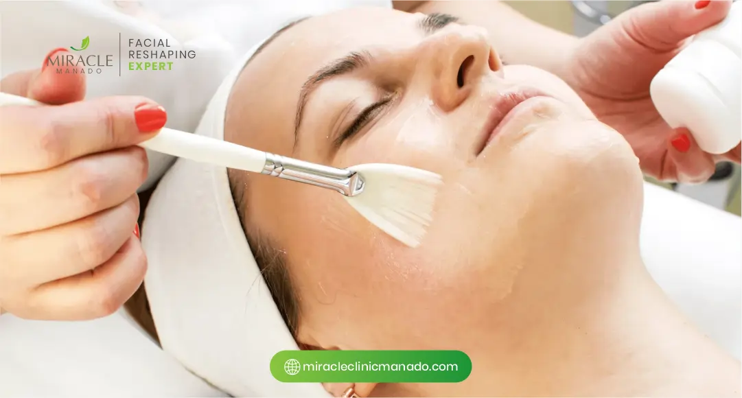 Jenis Peeling Kimia untuk Kulit Berjerawat yang Efektif