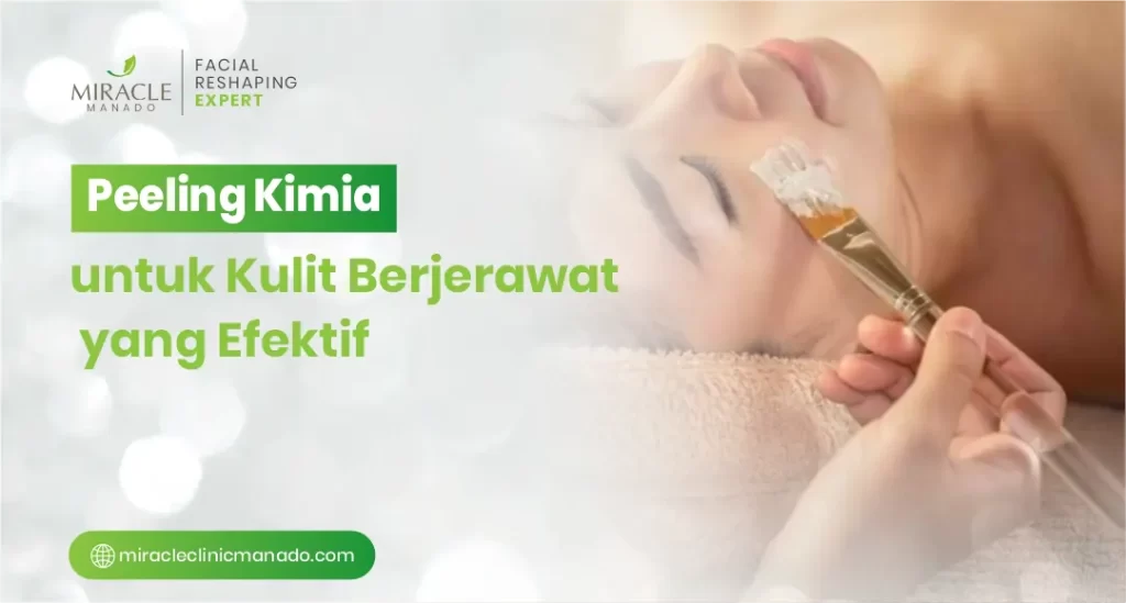 Peeling Kimia untuk Kulit Berjerawat yang Efektif