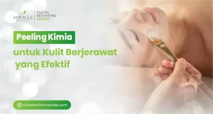 Peeling Kimia untuk Kulit Berjerawat yang Efektif