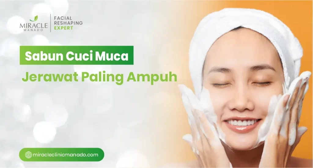 Sabun Cuci Muka Jerawat Paling Ampuh