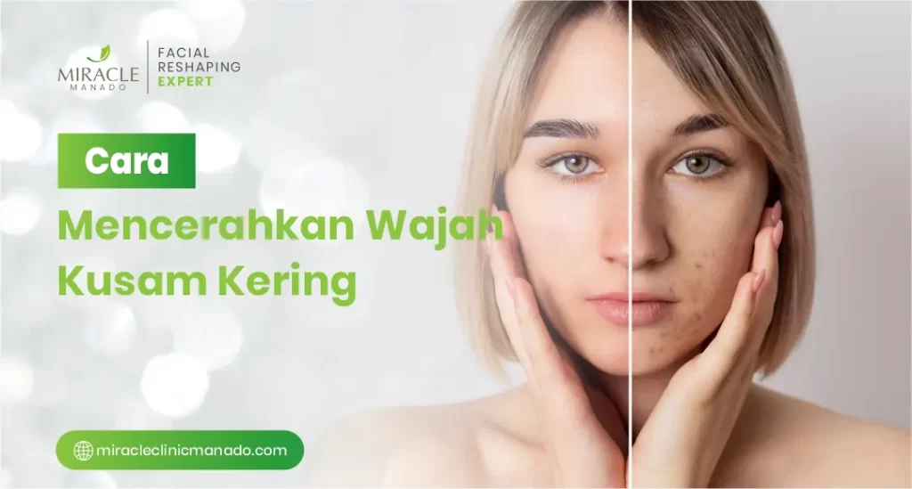 Cara Mencerahkan Wajah Kusam Kering