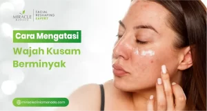 Cara Mengatasi Wajah Kusam Berminyak
