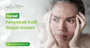 Kenali Penyebab Kulit Wajah Kusam