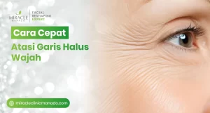 Cara Cepat Atasi Garis Halus Wajah