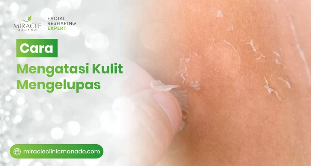 Cara Mengatasi Kulit Mengelupas