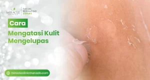 Cara Mengatasi Kulit Mengelupas