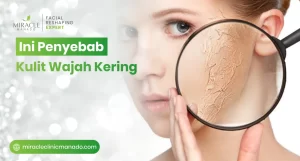 Ini Penyebab Kulit Wajah Kering