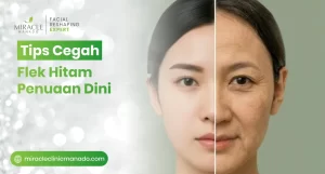 Tips Cegah Flek Hitam Penuaan Dini