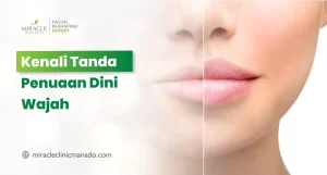 Kenali Tanda Penuaan Dini Wajah