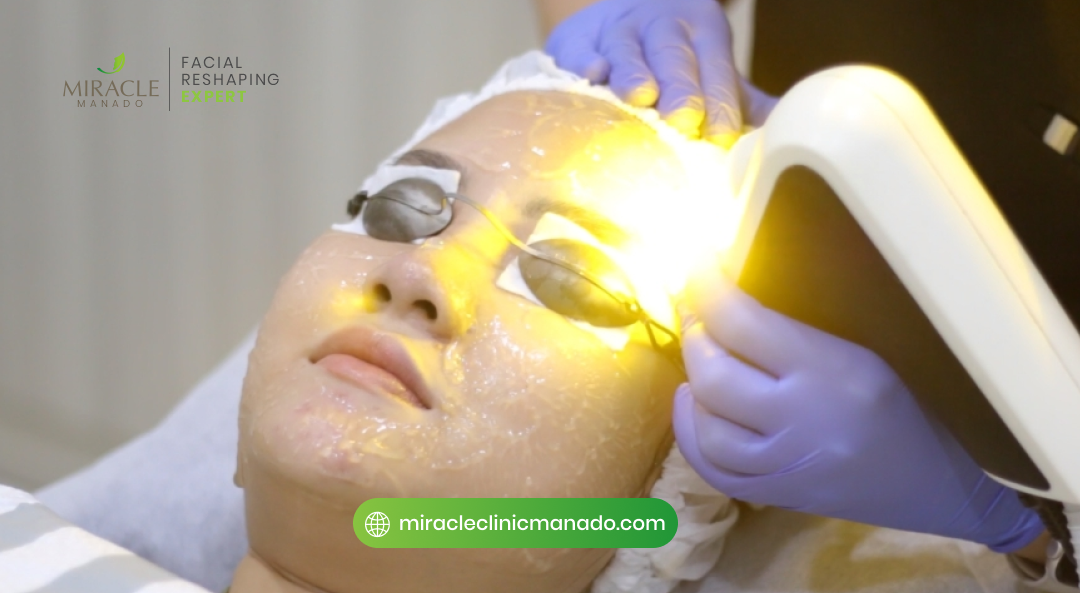 04 Tips Perawatan Setelah MD Laser agar Hasil Optimal