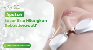 Apakah Laser Bisa Hilangkan Bekas Jerawat?